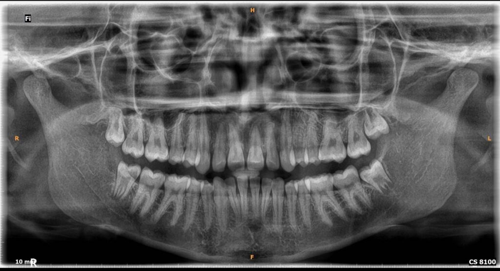 3d anomaly scan kalyan