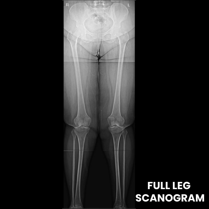 Scanogram kalyan